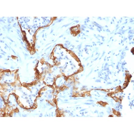 Immunohistochemistry - Anti-Cytokeratin 8 Antibody [SPM192] (A249152) - Antibodies.com