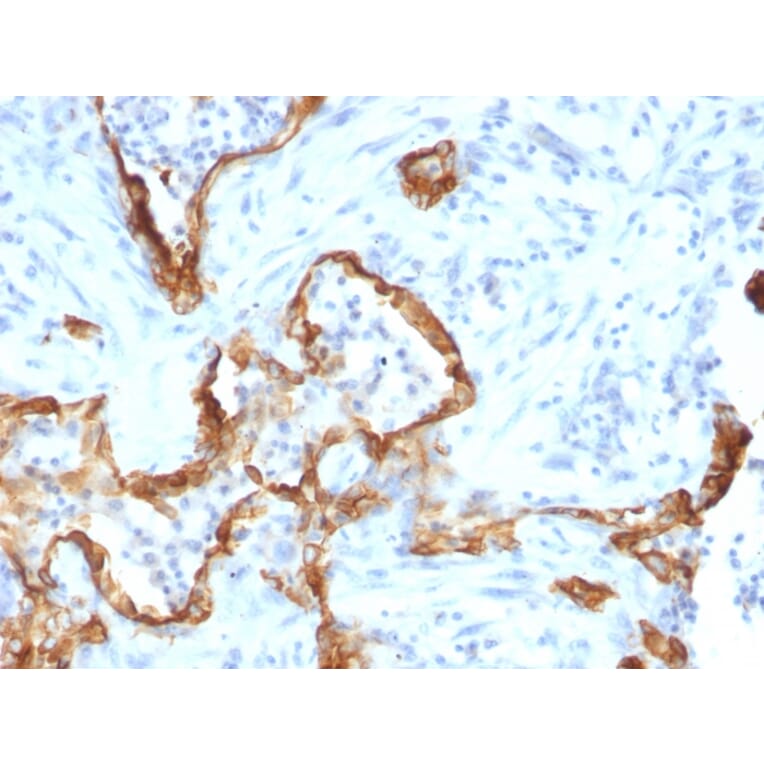 Immunohistochemistry - Anti-Cytokeratin 8 Antibody [SPM192] (A249152) - Antibodies.com