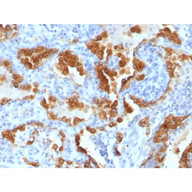 Immunohistochemistry - Anti-Cytokeratin 8 Antibody [H1+TS1] (A249153) - Antibodies.com