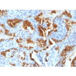 Immunohistochemistry - Anti-Cytokeratin 8 Antibody [H1+TS1] (A249153) - Antibodies.com