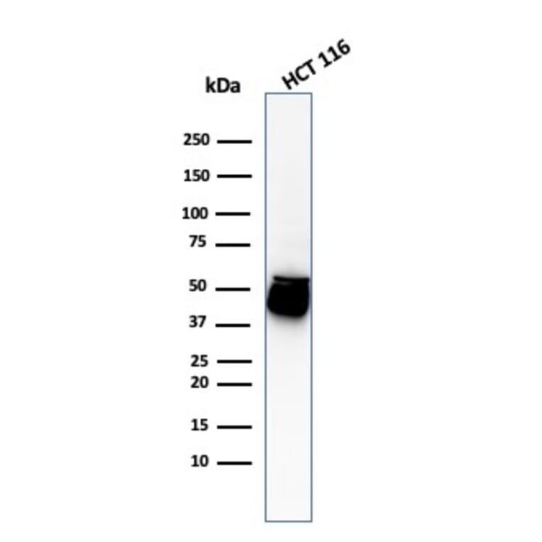 Western Blot - Anti-Cytokeratin 8 Antibody [H1+TS1] (A249153) - Antibodies.com