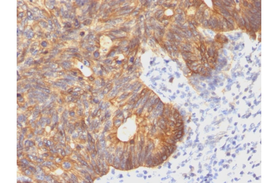 Immunohistochemistry - Anti-Cytokeratin 8 Antibody [C-43] (A249153) - Antibodies.com
