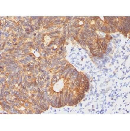 Immunohistochemistry - Anti-Cytokeratin 8 Antibody [C-43] (A249153) - Antibodies.com