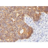 Immunohistochemistry - Anti-Cytokeratin 8 Antibody [C-43] (A249153) - Antibodies.com