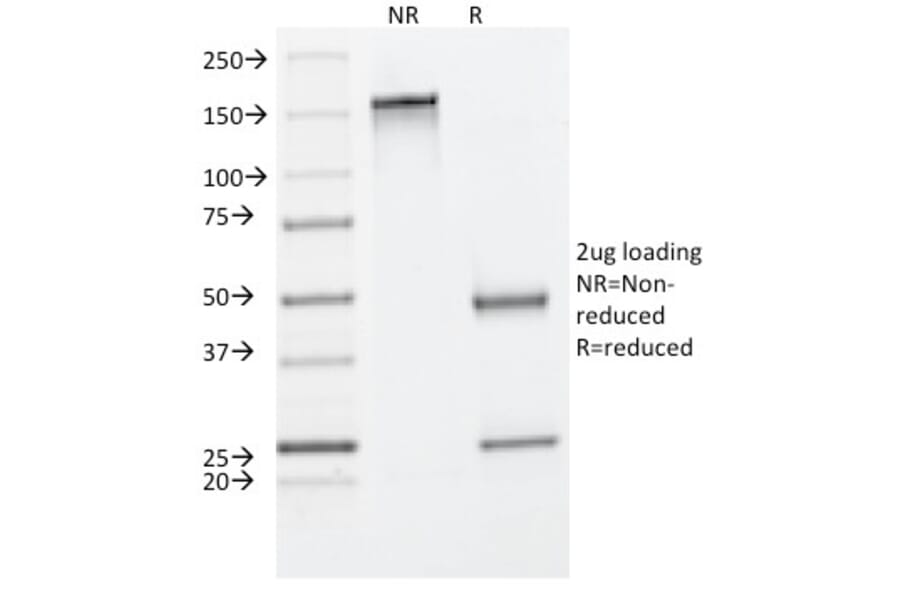 SDS-PAGE - Anti-Cytokeratin 8 Antibody [C-43] (A249154) - Antibodies.com
