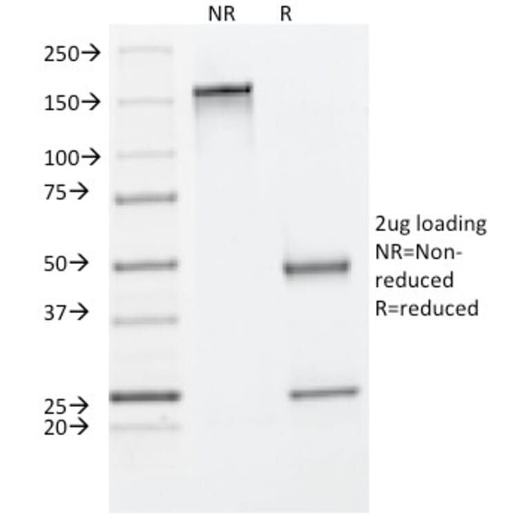 SDS-PAGE - Anti-Cytokeratin 8 Antibody [C-43] (A249154) - Antibodies.com