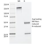 SDS-PAGE - Anti-Cytokeratin 8 Antibody [C-43] (A249154) - Antibodies.com