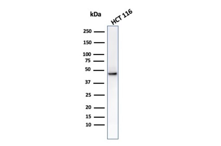 Western Blot - Anti-Cytokeratin 8 Antibody [C-43] (A249154) - Antibodies.com