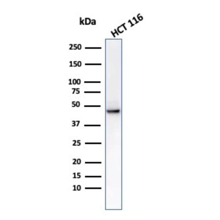Western Blot - Anti-Cytokeratin 8 Antibody [C-43] (A249154) - Antibodies.com