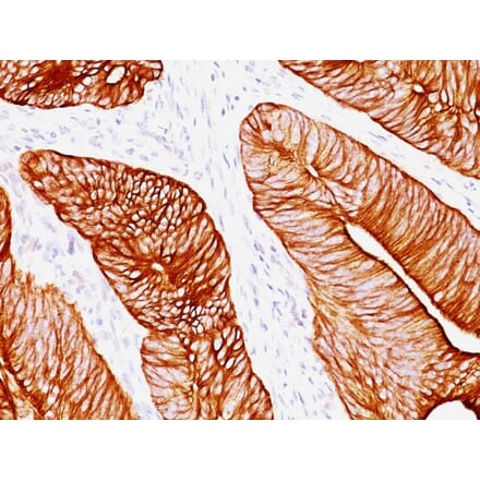 Immunohistochemistry - Anti-Cytokeratin 8 Antibody [K8.8] (A249155) - Antibodies.com