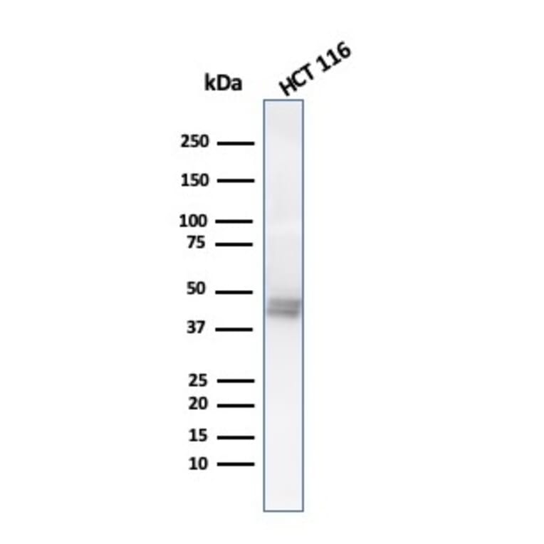 Western Blot - Anti-Cytokeratin 8 Antibody [K8.8] (A249155) - Antibodies.com