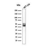 Western Blot - Anti-Cytokeratin 8 Antibody [KRT8/803] (A249156) - Antibodies.com