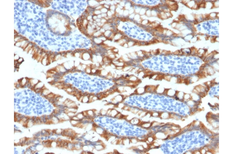 Immunohistochemistry - Anti-Cytokeratin 8 Antibody [KRT8/2174R] (A249156) - Antibodies.com