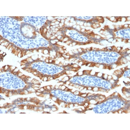 Immunohistochemistry - Anti-Cytokeratin 8 Antibody [KRT8/2174R] (A249156) - Antibodies.com