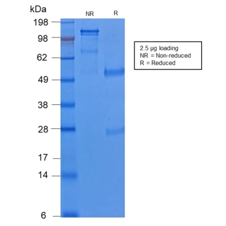 SDS-PAGE - Anti-Cytokeratin 8 Antibody [KRT8/2174R] (A249157) - Antibodies.com