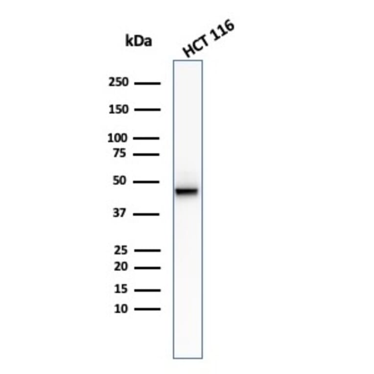 Western Blot - Anti-Cytokeratin 8 Antibody [KRT8/2174R] (A249157) - Antibodies.com