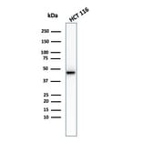 Western Blot - Anti-Cytokeratin 8 Antibody [KRT8/2174R] (A249157) - Antibodies.com