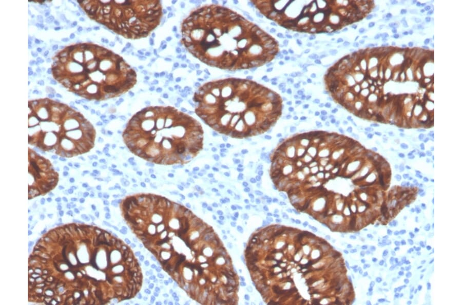 Immunohistochemistry - Anti-Cytokeratin 8 Antibody [KRT8/4067R] (A249158) - Antibodies.com