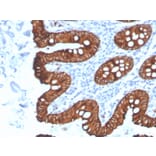 Immunohistochemistry - Anti-Cytokeratin 8 Antibody [KRT8/4067R] (A249157) - Antibodies.com