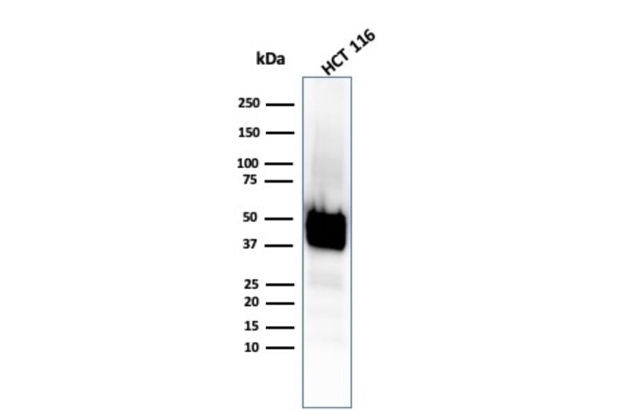 Western Blot - Anti-Cytokeratin 8 Antibody [KRT8/4067R] (A249158) - Antibodies.com