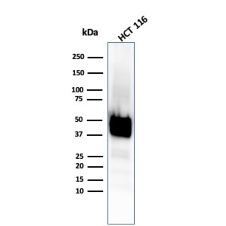 Western Blot - Anti-Cytokeratin 8 Antibody [KRT8/4067R] (A249158) - Antibodies.com