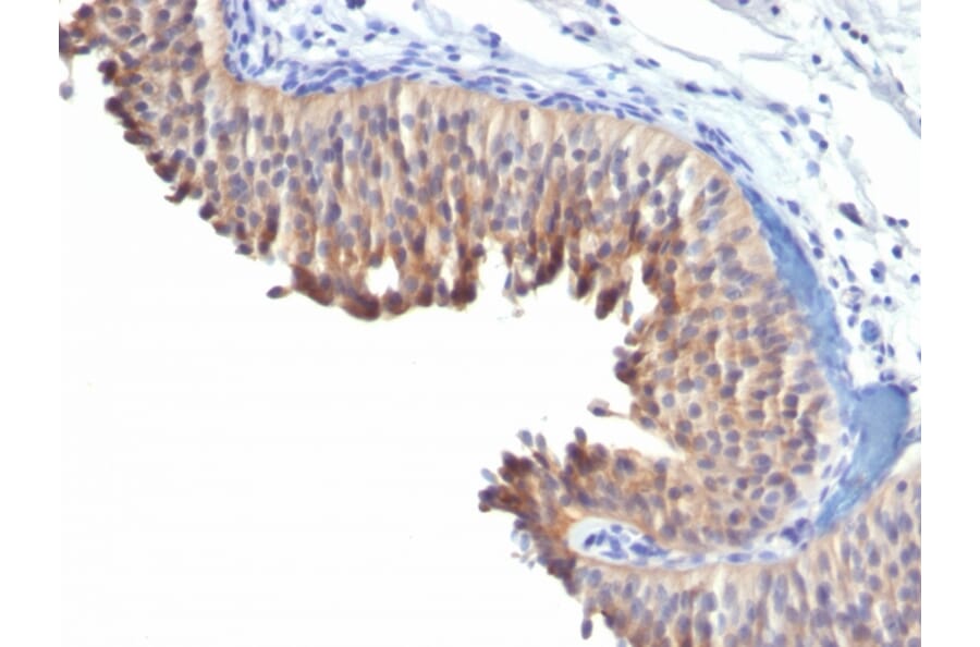 Immunohistochemistry - Anti-Cytokeratin 10 Antibody [LH2] (A249158) - Antibodies.com