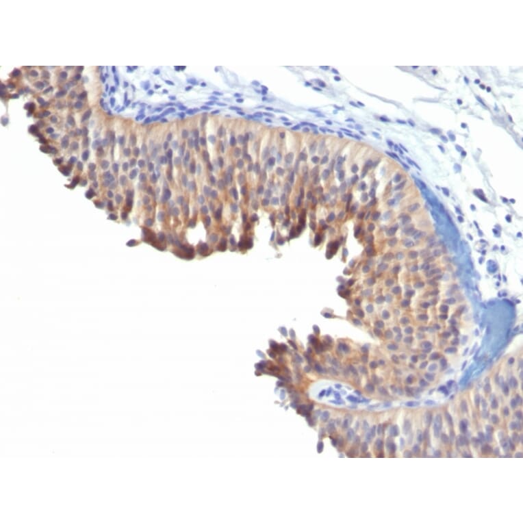 Immunohistochemistry - Anti-Cytokeratin 10 Antibody [LH2] (A249158) - Antibodies.com