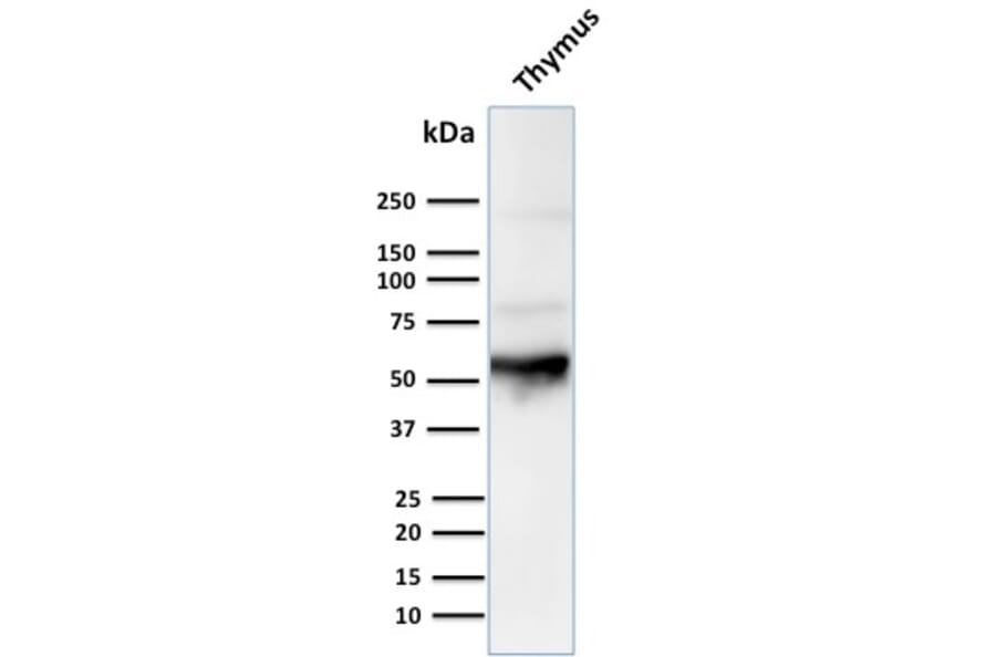 Western Blot - Anti-Cytokeratin 10 Antibody [LH2] (A249159) - Antibodies.com