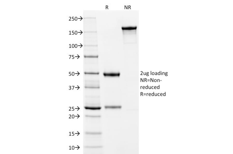 SDS-PAGE - Anti-Cytokeratin 10 Antibody [LH2] (A249159) - Antibodies.com