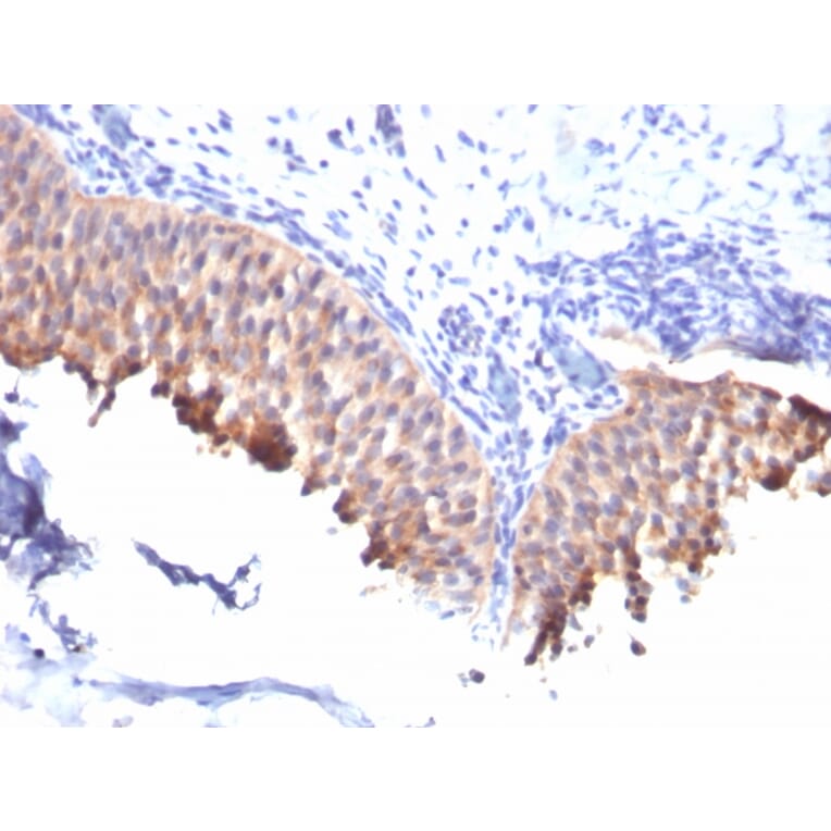 Immunohistochemistry - Anti-Cytokeratin 10 Antibody [SPM261] (A249159) - Antibodies.com