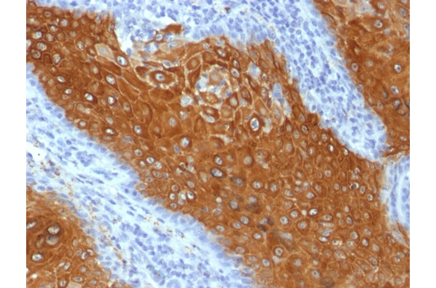 Immunohistochemistry - Anti-Cytokeratin 10 Antibody [KRT10/844] (A249160) - Antibodies.com