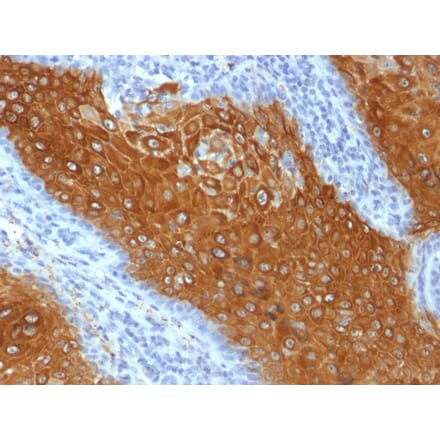 Immunohistochemistry - Anti-Cytokeratin 10 Antibody [KRT10/844] (A249160) - Antibodies.com
