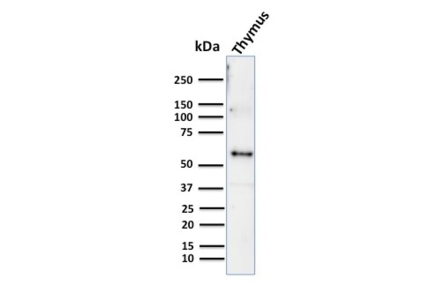 Western Blot - Anti-Cytokeratin 10 Antibody [KRT10/844] (A249161) - Antibodies.com