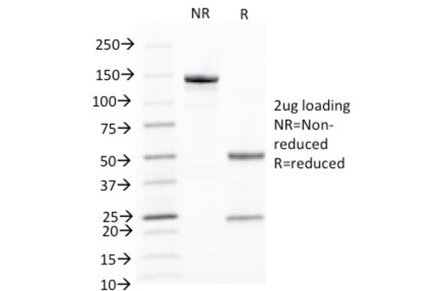SDS-PAGE - Anti-Cytokeratin 10 Antibody [KRT10/844] (A249161) - Antibodies.com