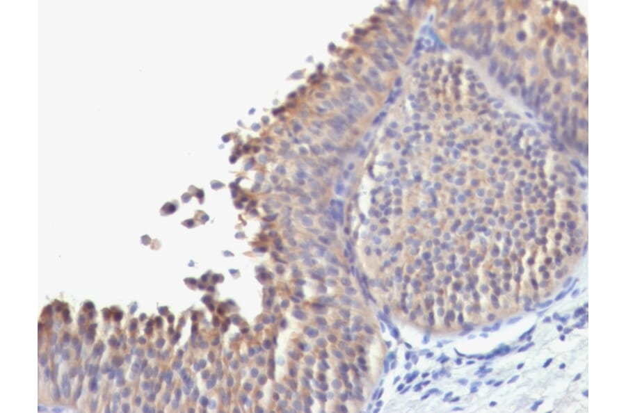 Immunohistochemistry - Anti-Cytokeratin 10 Antibody [SPM623] (A249162) - Antibodies.com