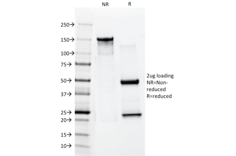 SDS-PAGE - Anti-Cytokeratin 10 Antibody [AE20] (A249164) - Antibodies.com
