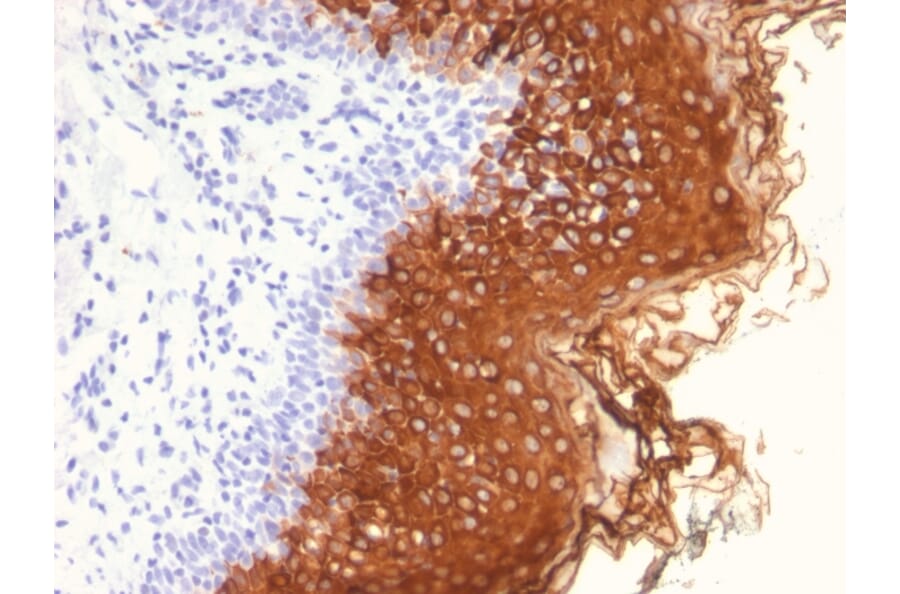 Immunohistochemistry - Anti-Cytokeratin 10 Antibody [AE20] (A249163) - Antibodies.com