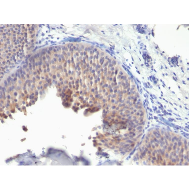 Immunohistochemistry - Anti-Cytokeratin 10 Antibody [KRT10/1275] (A249164) - Antibodies.com