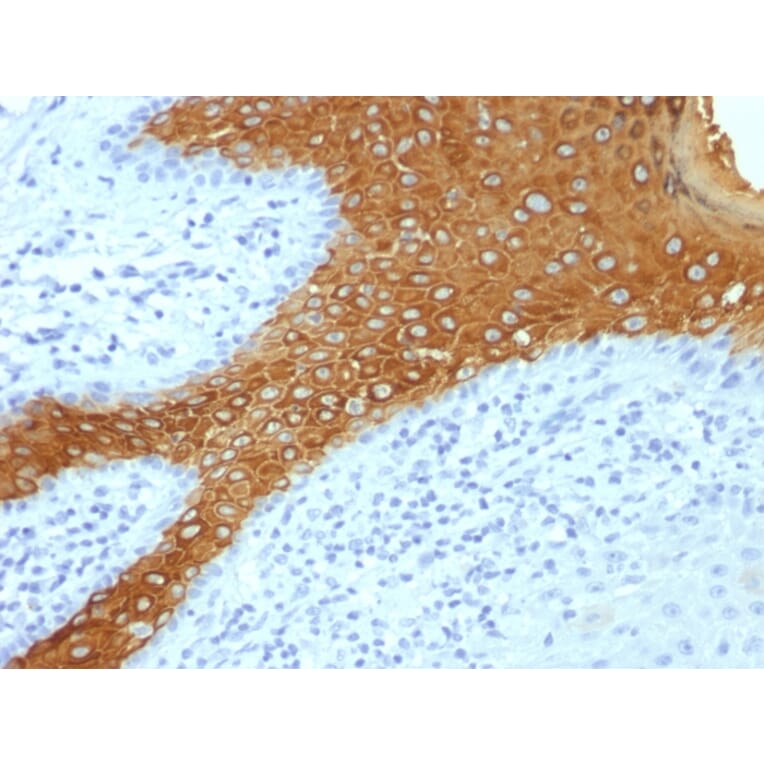 Immunohistochemistry - Anti-Cytokeratin 10 Antibody [KRT10/844 + KRT10/1275] (A249165) - Antibodies.com