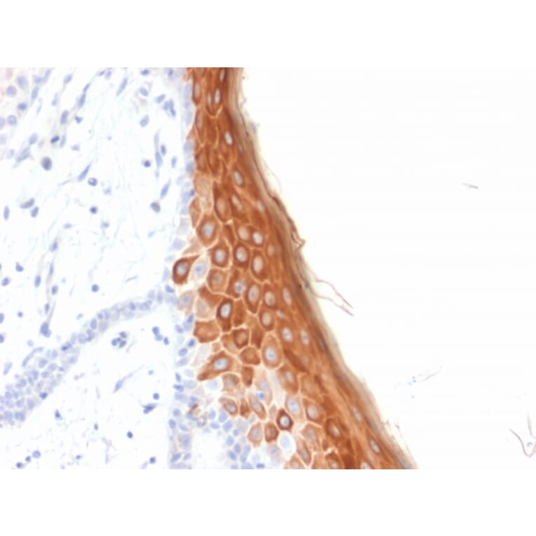 Immunohistochemistry - Anti-Cytokeratin 10 Antibody [rKRT10/844] (A249167) - Antibodies.com