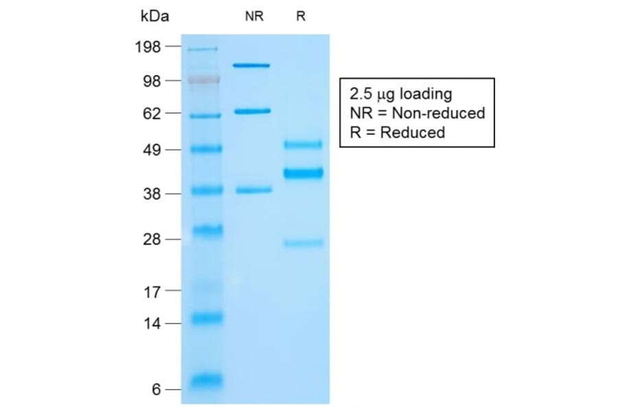 SDS-PAGE - Anti-Cytokeratin 10 Antibody [rKRT10/844] (A249168) - Antibodies.com