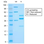 SDS-PAGE - Anti-Cytokeratin 10 Antibody [rKRT10/844] (A249168) - Antibodies.com