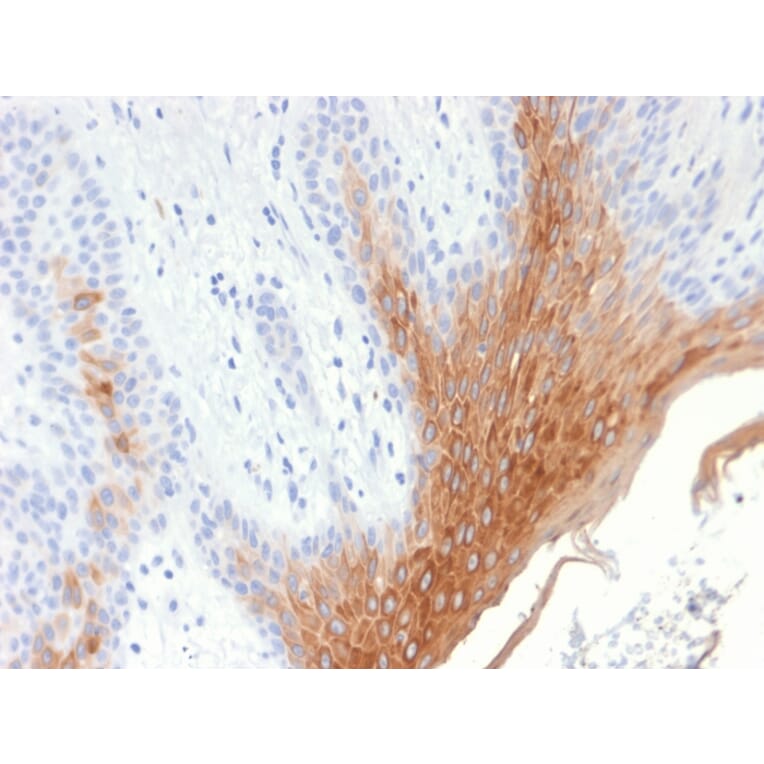 Immunohistochemistry - Anti-Cytokeratin 10 Antibody [KRT10/1990R] (A249168) - Antibodies.com