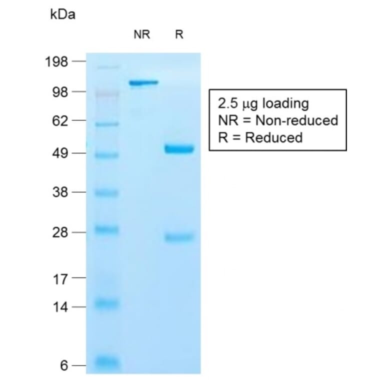 SDS-PAGE - Anti-Cytokeratin 10 Antibody [KRT10/1990R] (A249169) - Antibodies.com