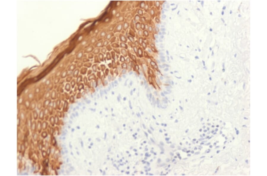 Immunohistochemistry - Anti-Cytokeratin 10 Antibody [KRT10/1948R] (A249169) - Antibodies.com