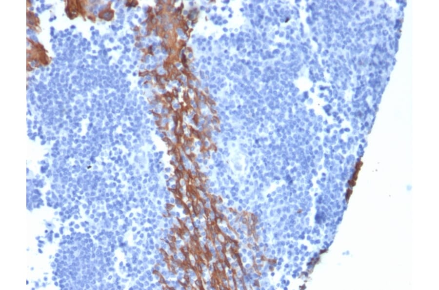 Immunohistochemistry - Anti-Cytokeratin 13 Antibody [KRT13/2659] (A249171) - Antibodies.com