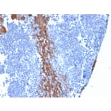 Immunohistochemistry - Anti-Cytokeratin 13 Antibody [KRT13/2659] (A249171) - Antibodies.com
