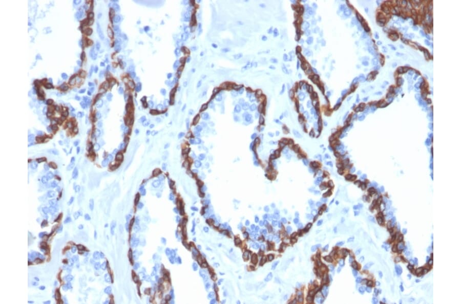 Immunohistochemistry - Anti-Cytokeratin 13 Antibody [KRT13/2659] (A249171) - Antibodies.com