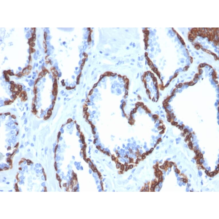 Immunohistochemistry - Anti-Cytokeratin 13 Antibody [KRT13/2659] (A249171) - Antibodies.com