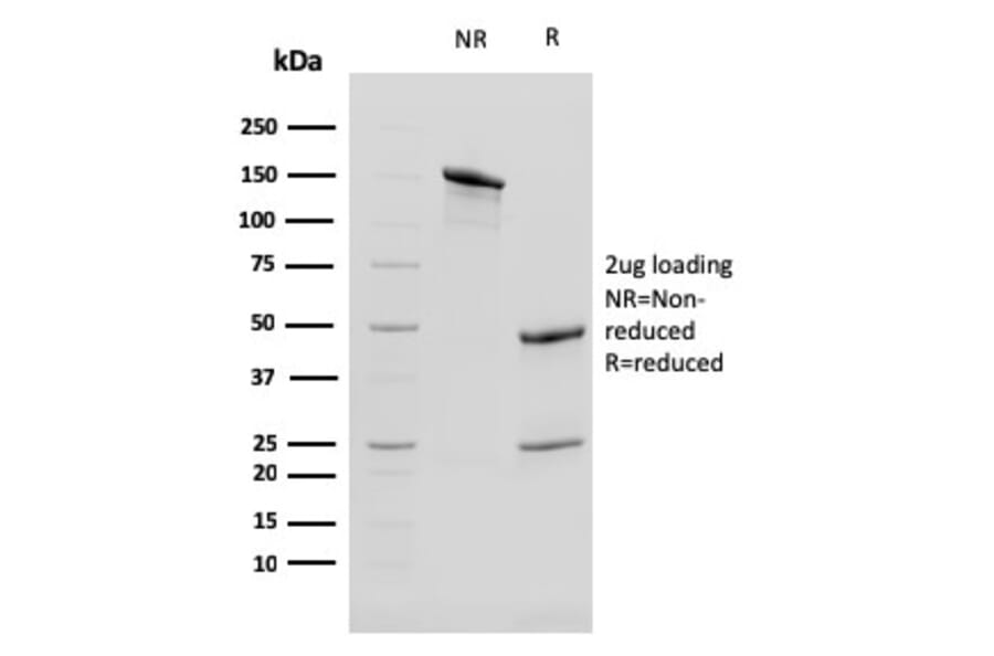 SDS-PAGE - Anti-Cytokeratin 13 Antibody [KRT13/2659] (A249171) - Antibodies.com